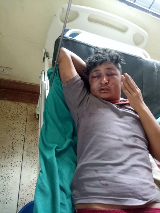 नशाको तालमा वडा सदस्यले गरे आफ्नै छोरालाई आक्रमण