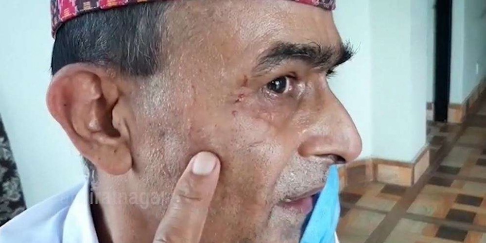 प्रेम सञ्जेलमाथि  कार्यकक्षमै महिला कर्मचारीद्वारा आक्रमण