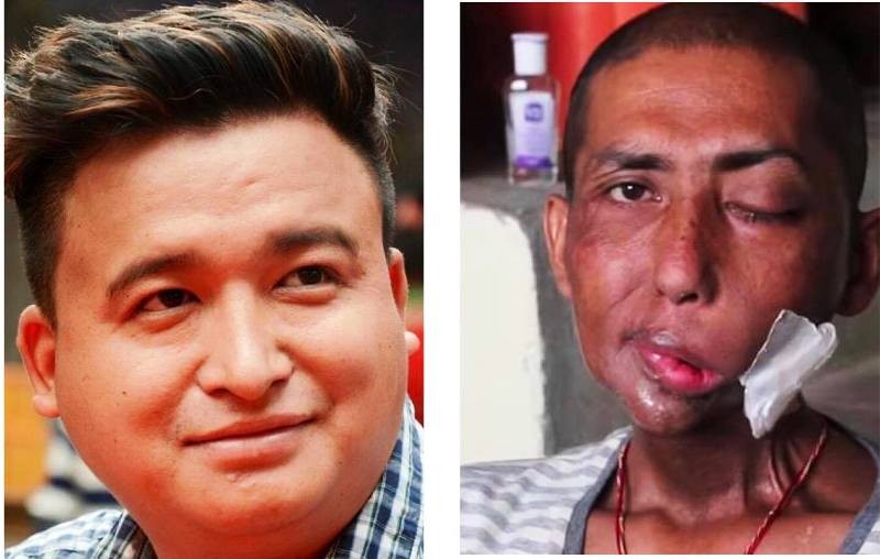 घाइते कमाण्डर जमिनलाई दिल निशानी मगरले गरे आर्थिक सहयोग