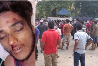प्रहरी हिरासतमा रहेका रोशन विकको मृत्युप्रति राष्ट्रिय मानव अधिकार आयोगको निरीक्षण :हिरासतको सुरक्षा अवस्था कमजोर
