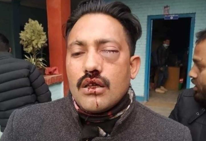 विरोध प्रदर्शनका क्रममा अनेरास्ववियूका केन्द्रीय सदस्य कार्की प्रहरीबाट कुटिए