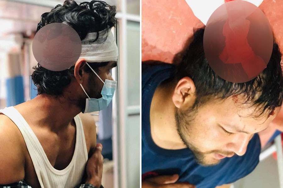 चितवनस्थित रामपुर कृषि क्याम्पसमा दुई विद्यार्थी संगठनबीच दोहोरो झडप चारजना घाइते