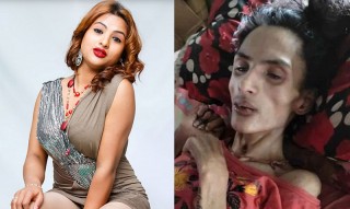 कलाकार निशा घिमिरेको उपचारका लागि बैंक खाता सञ्चालनमा