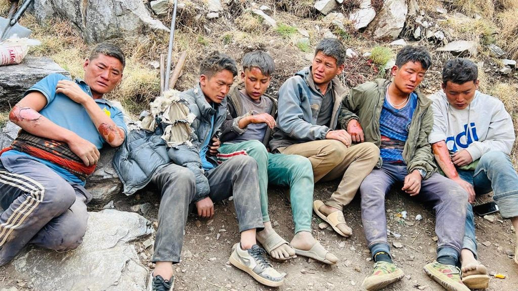 गोरेटो खनिरहेकाहरु आगलागीमा परी ६ जना घाइते